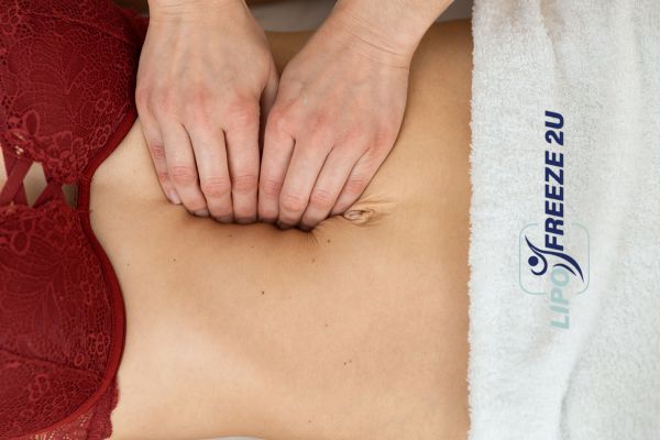 diastasis recti treatment Hamilton