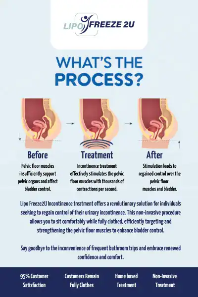 Diagram of how incontinence treatment Hamilton works.