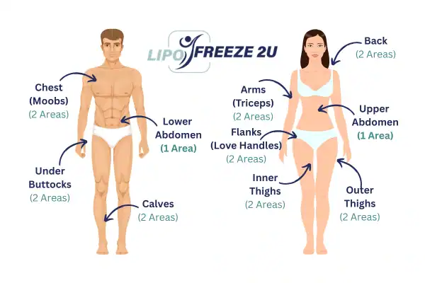 Areas you can have fat freezing treatment Hamilton