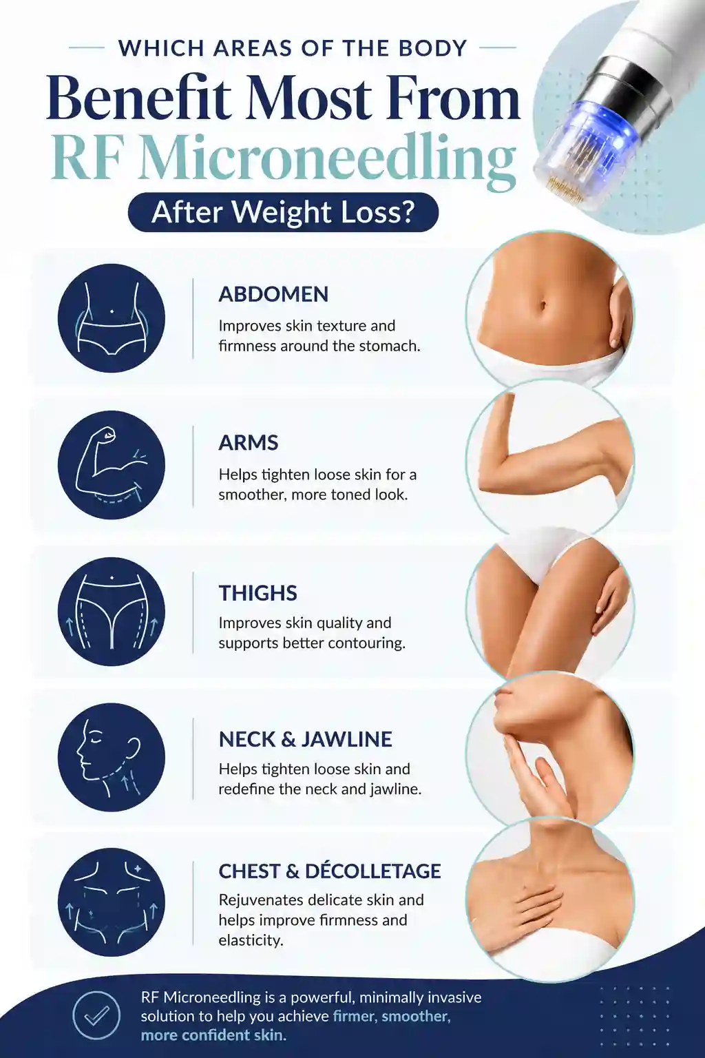 Which Areas of the Body Benefit Most From RF Microneedling After Weight Loss Hamilton
